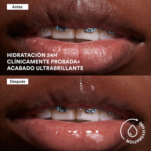 Load image  in gallery view